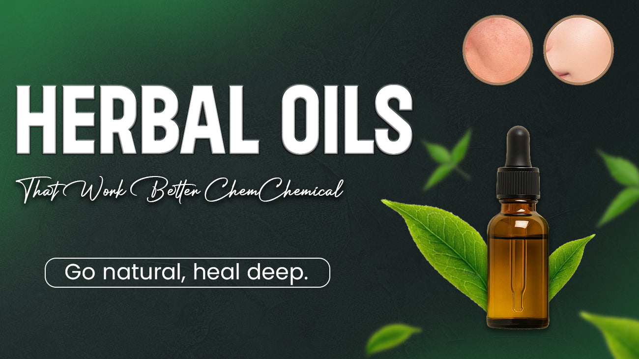 Herbal Oils That Work Better Than Chemical Creams
